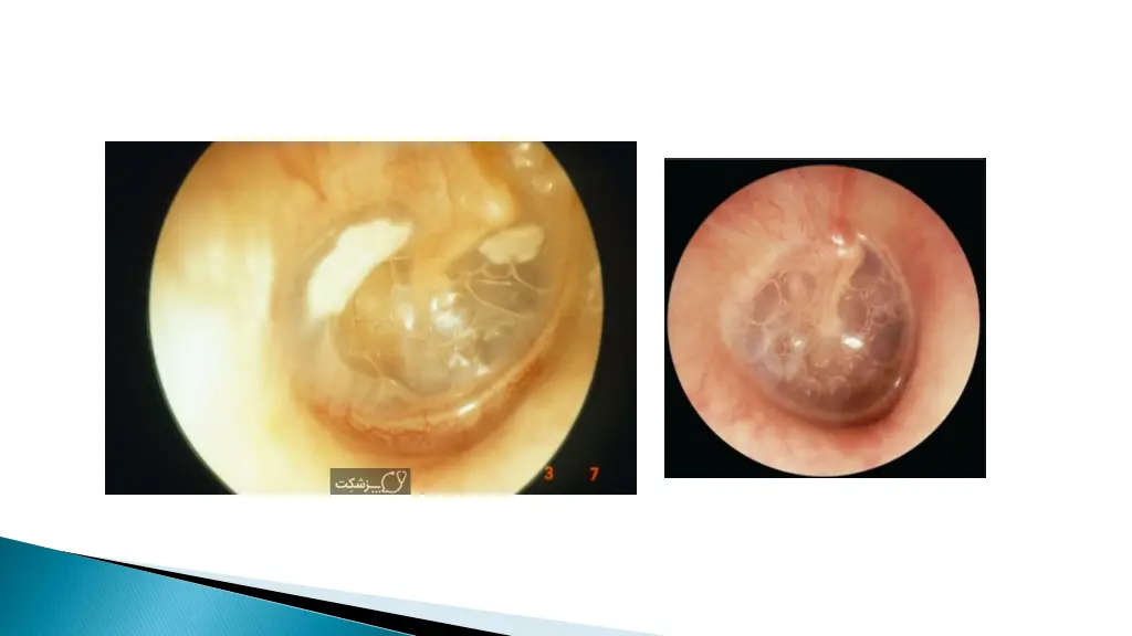 slide12