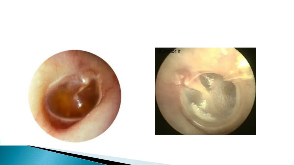 slide13