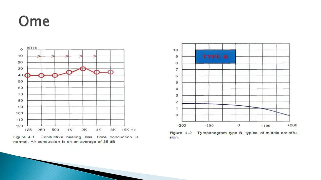 slide15