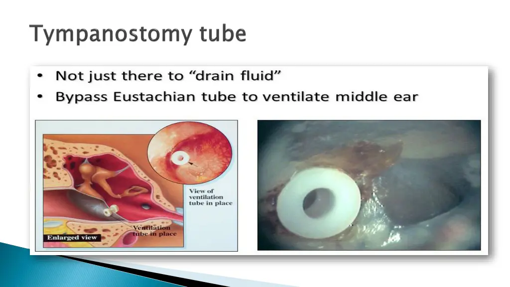 slide37