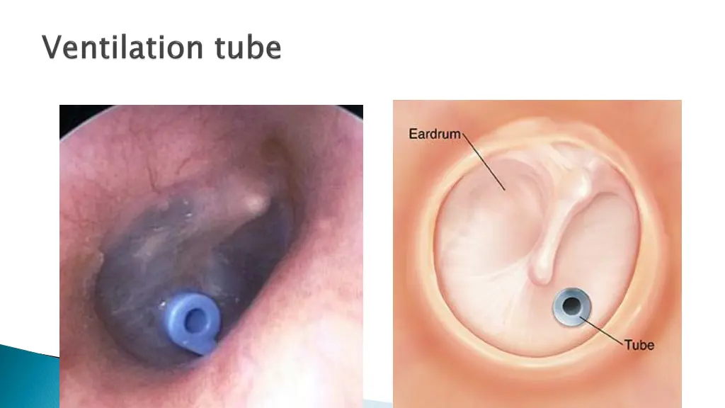 slide38