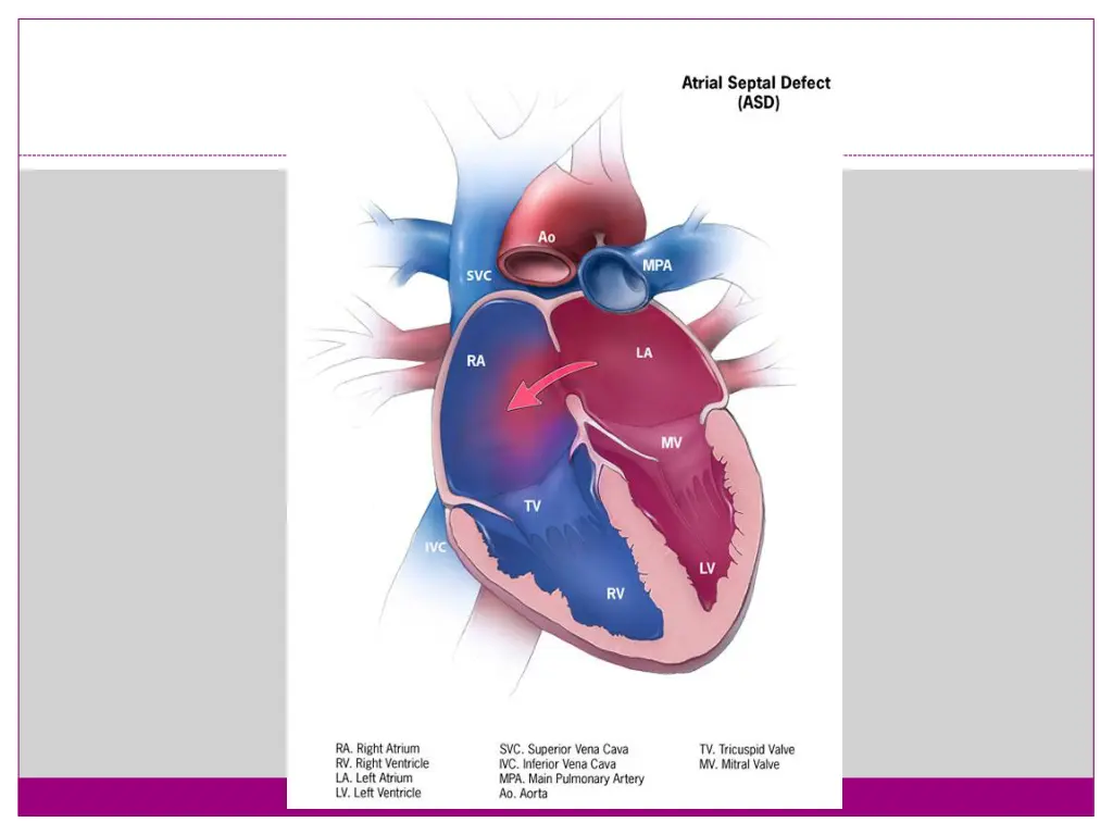 slide24