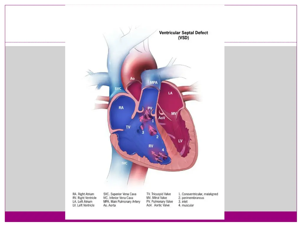 slide27