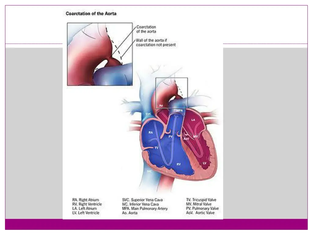 slide31