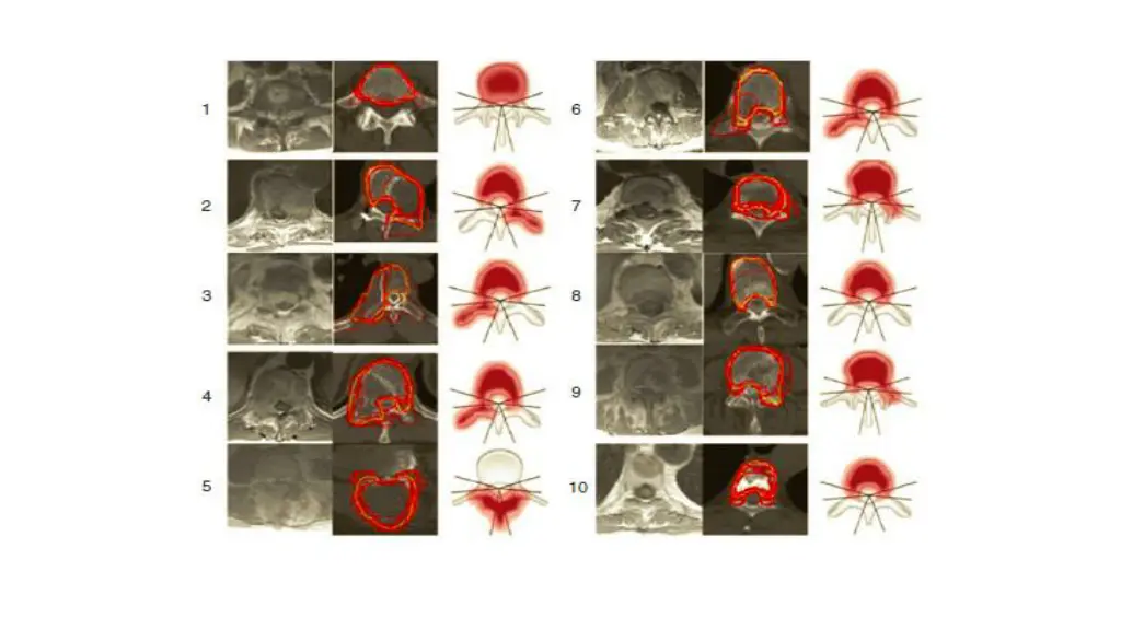 slide11