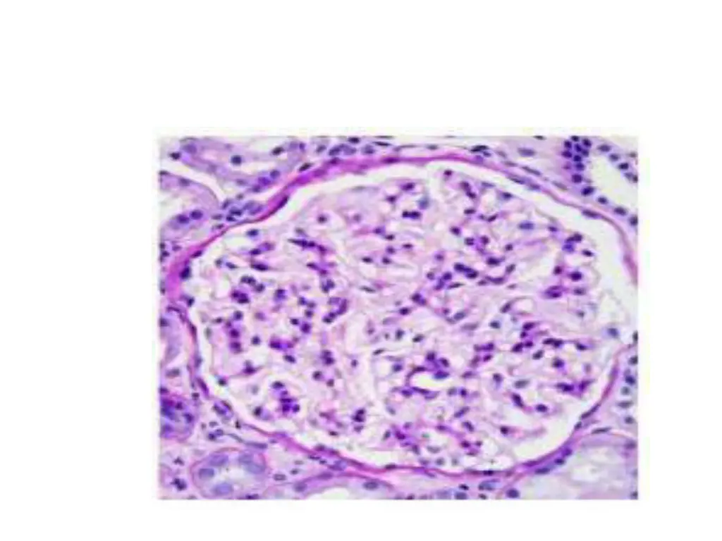 slide3