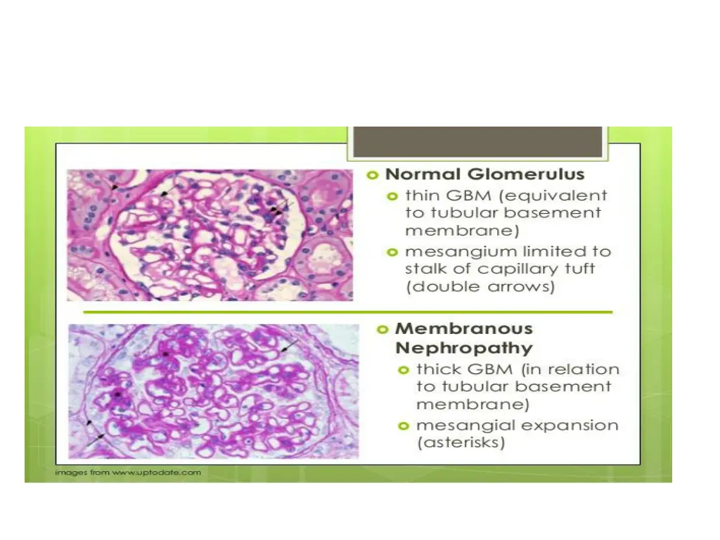 slide31