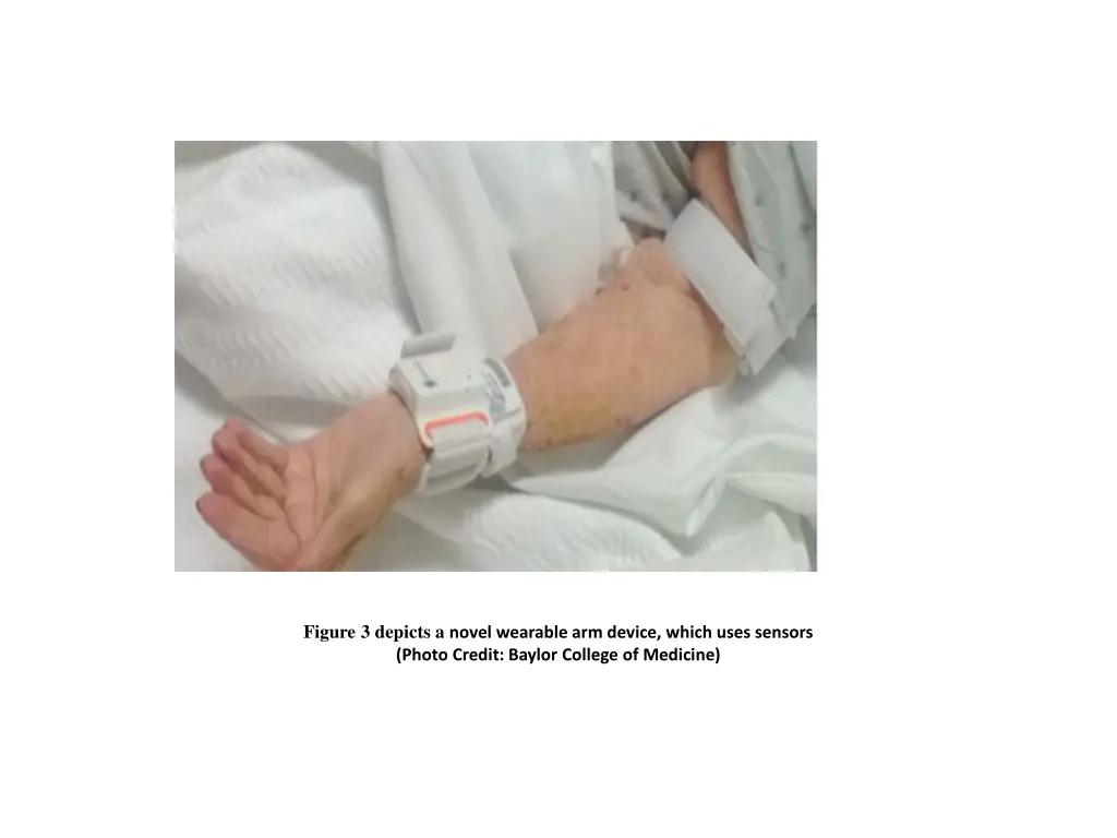 figure 3 depicts a novel wearable arm device