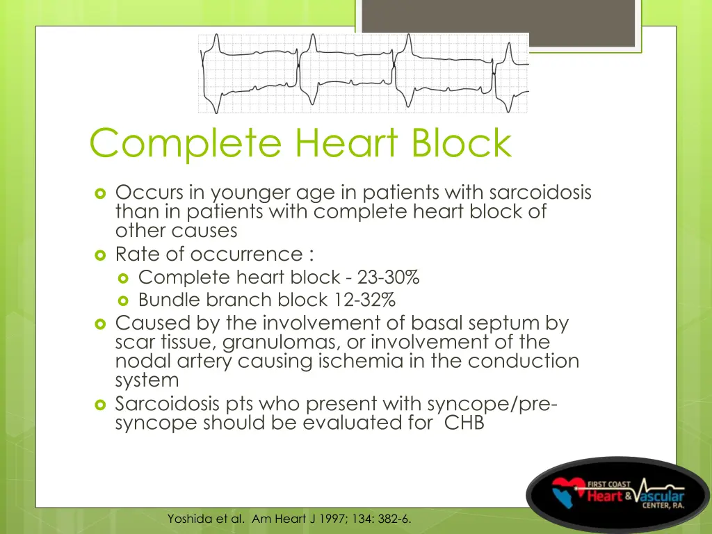 complete heart block
