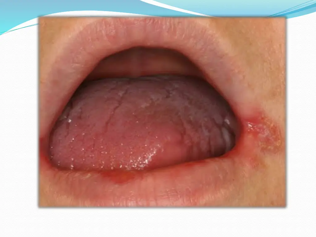 slide11
