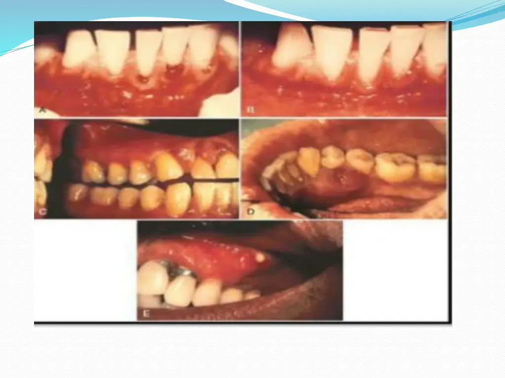 slide13