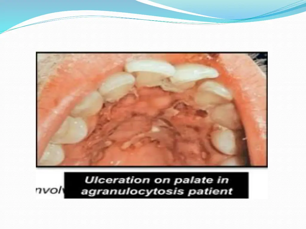 slide35