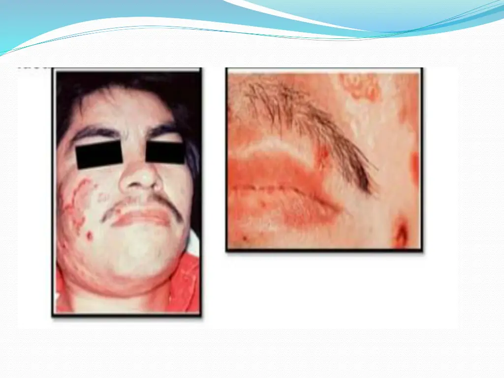 slide43