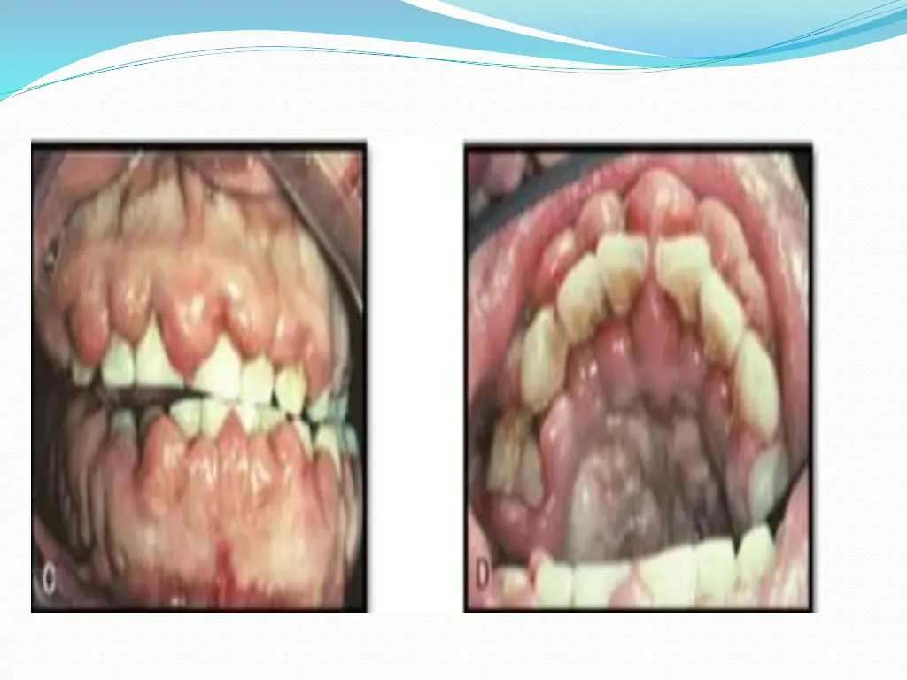slide47