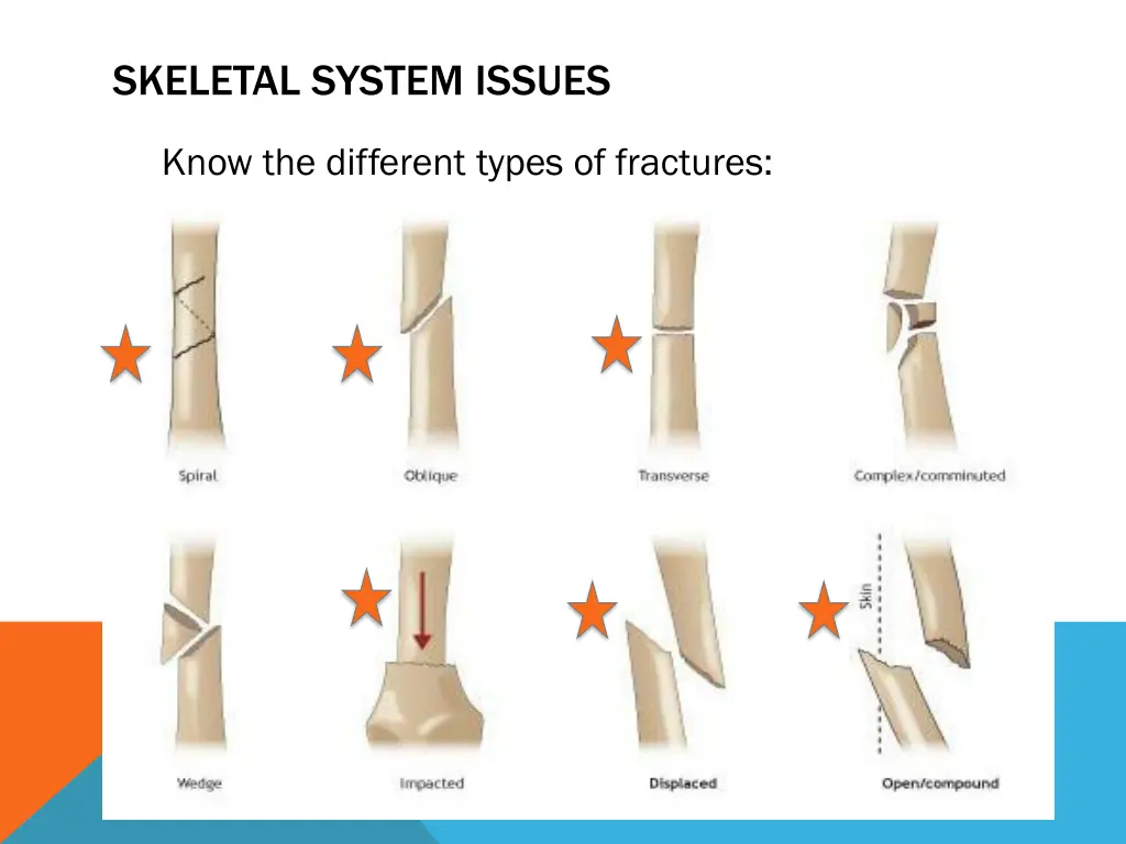 skeletal system issues