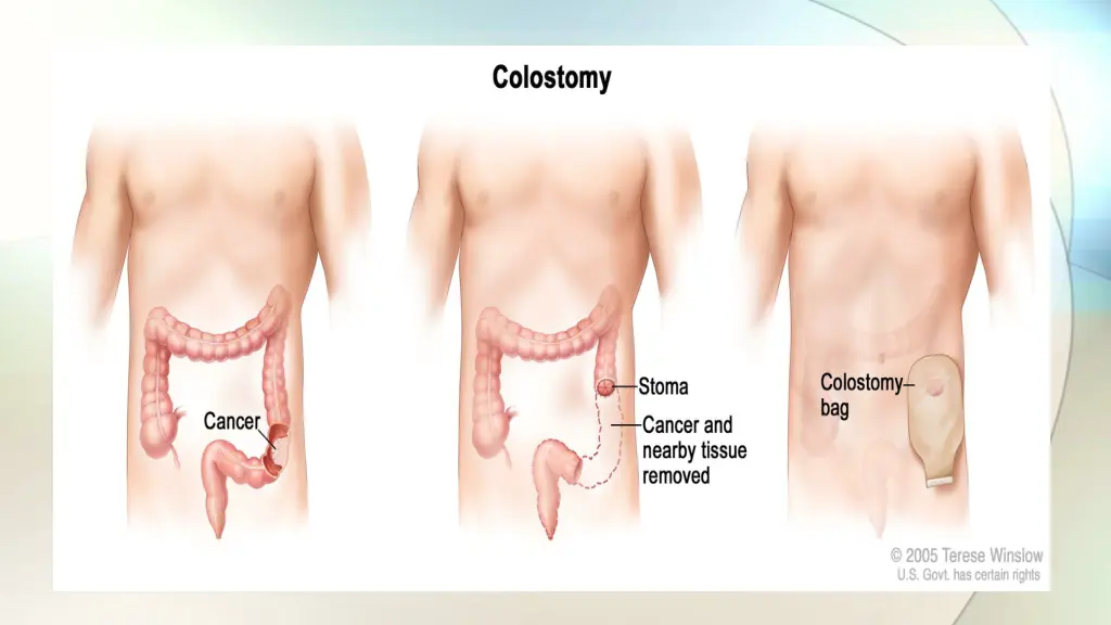 slide7