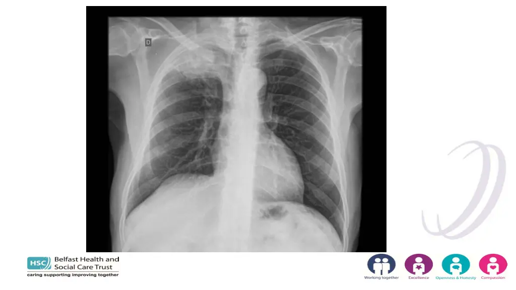 slide11
