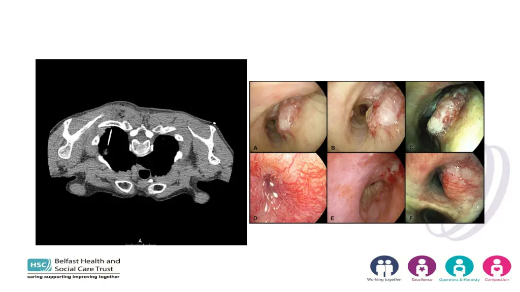 slide16