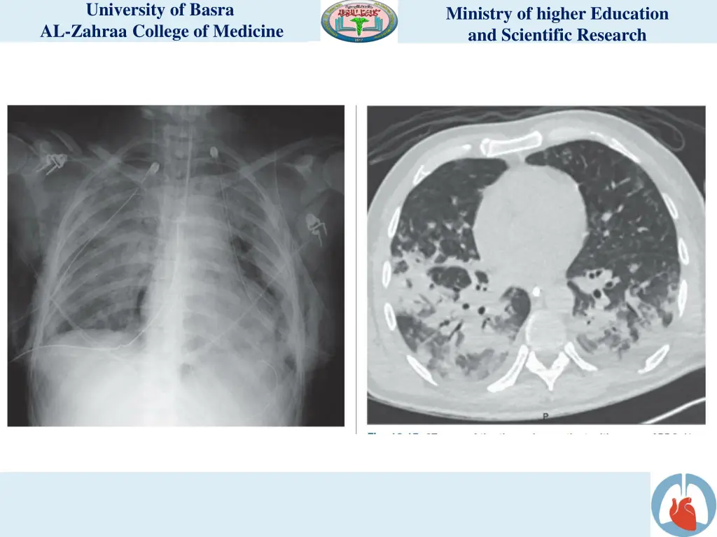 university of basra al zahraa college of medicine 9