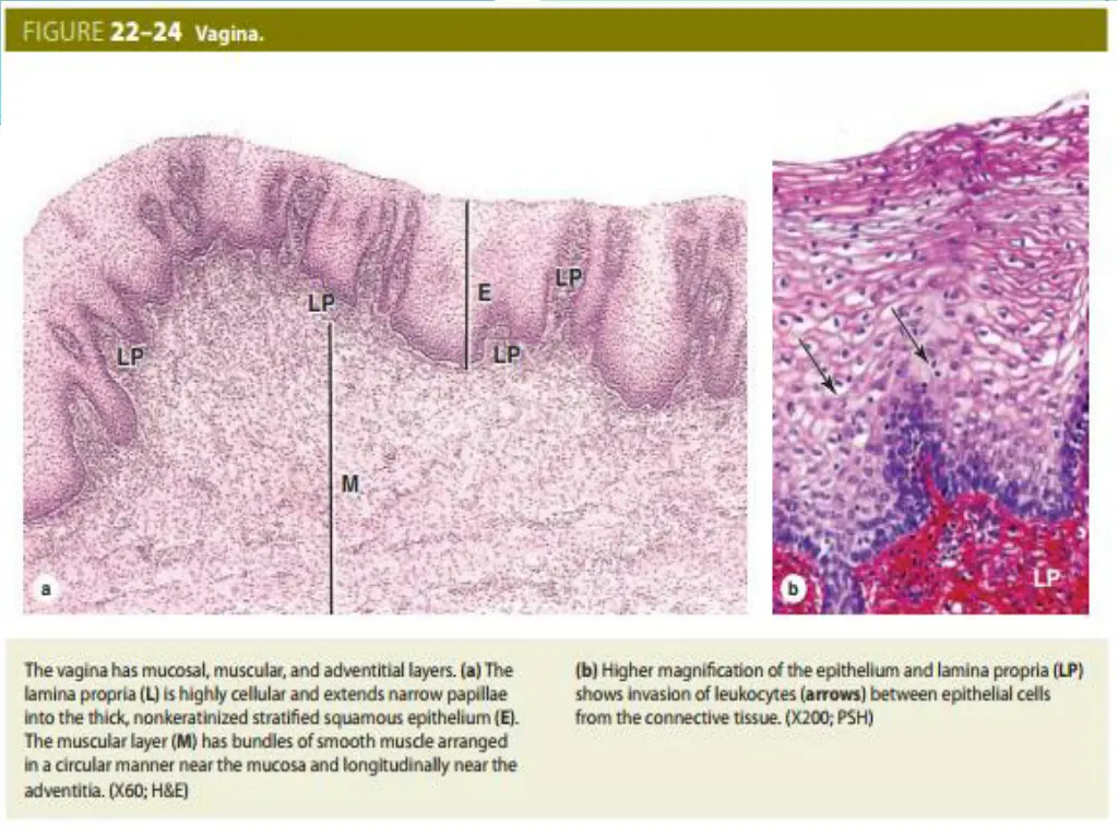 slide14