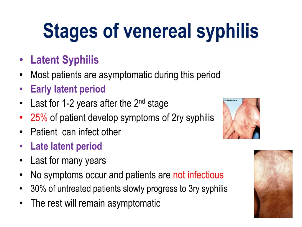 stages of venereal syphilis