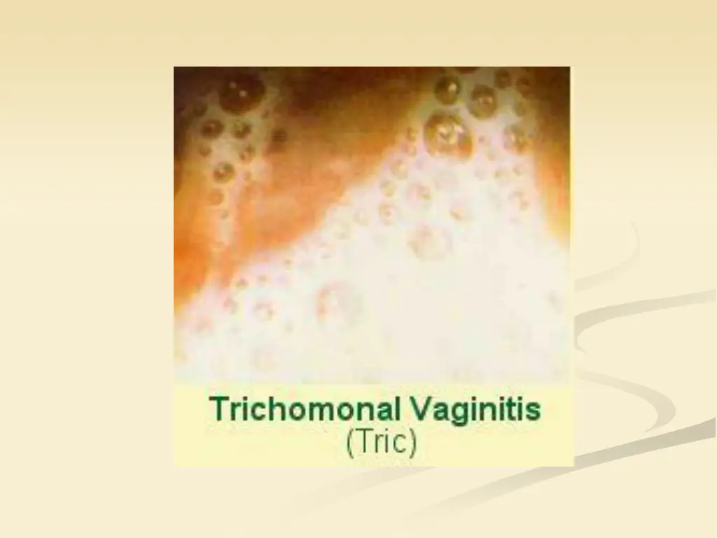 slide14