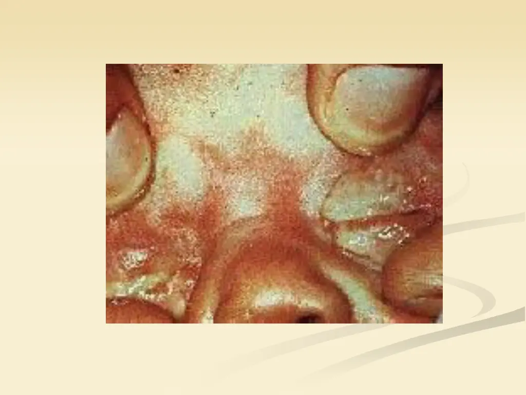 slide20
