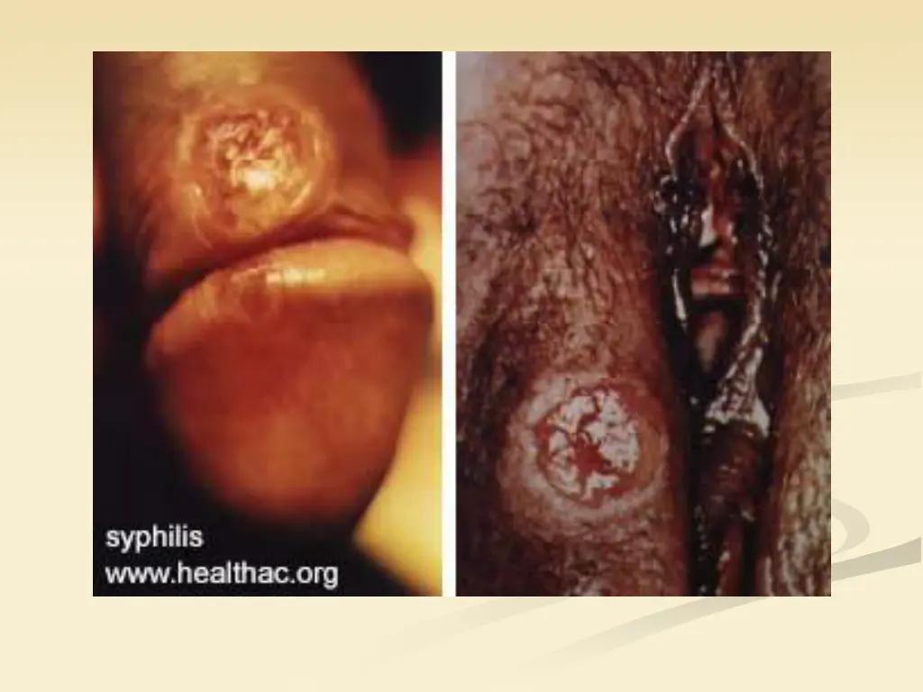 slide28