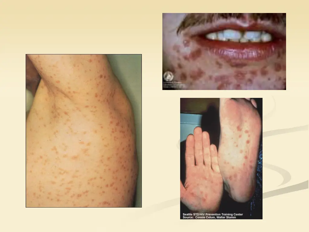 slide30