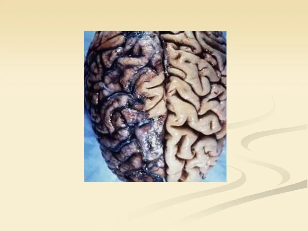 slide33