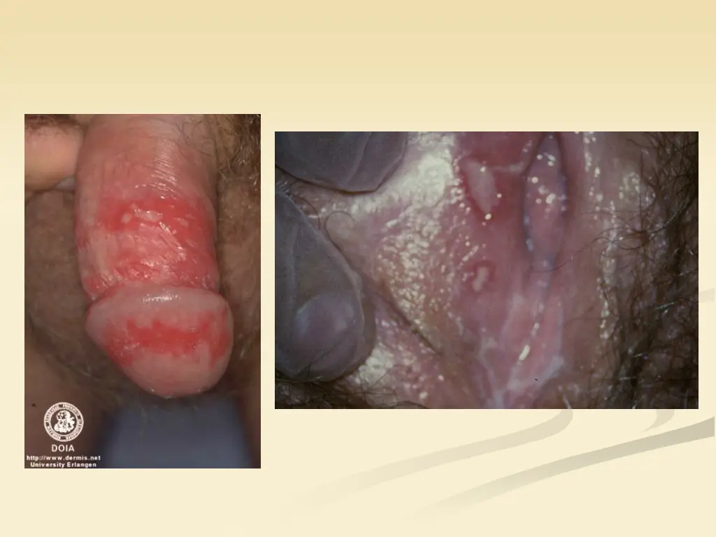 slide36