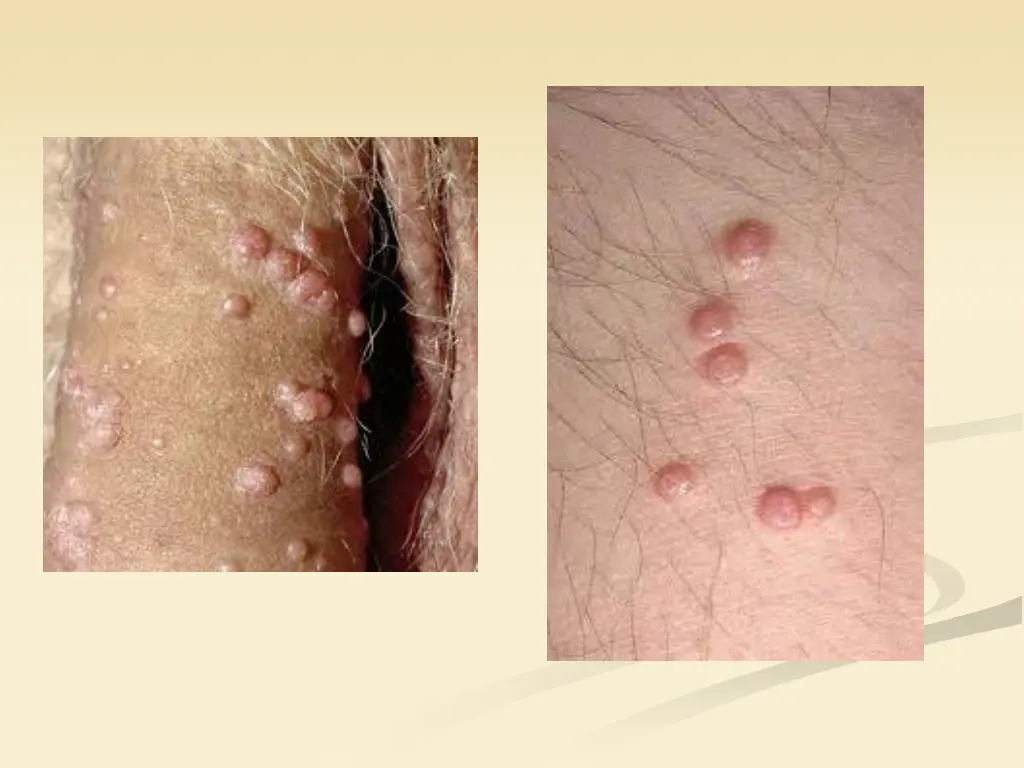 slide41