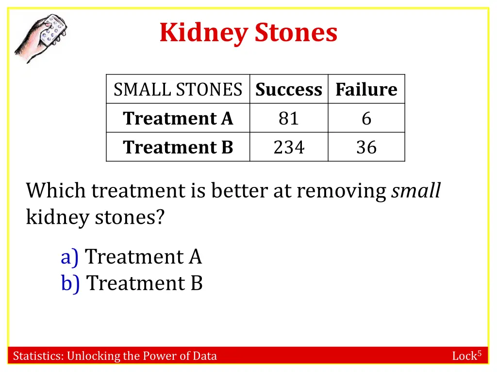 kidney stones 1