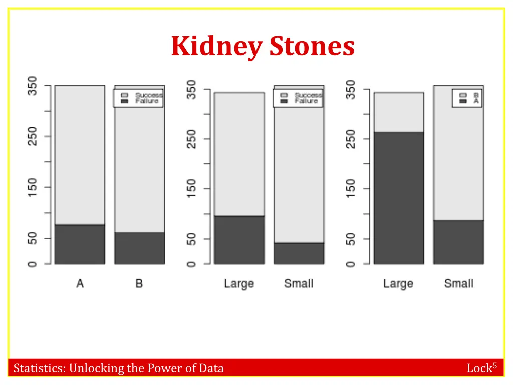 kidney stones 5