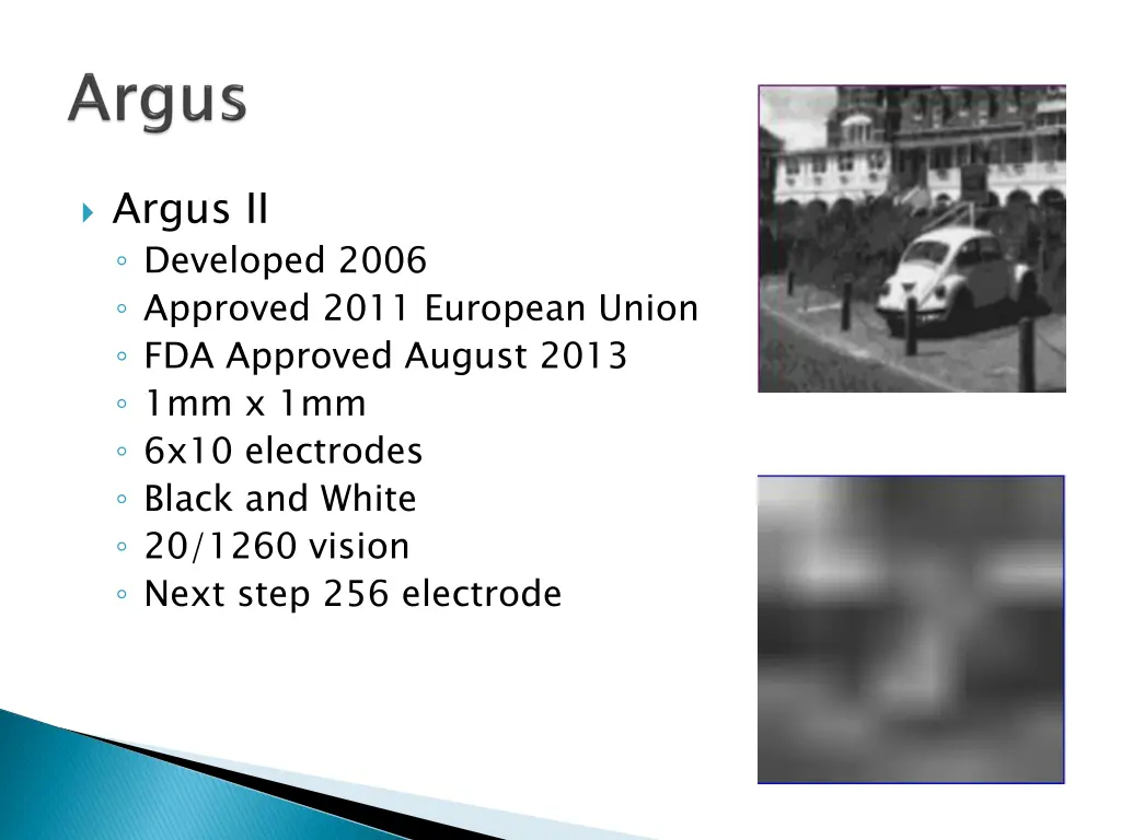 argus ii developed 2006 approved 2011 european
