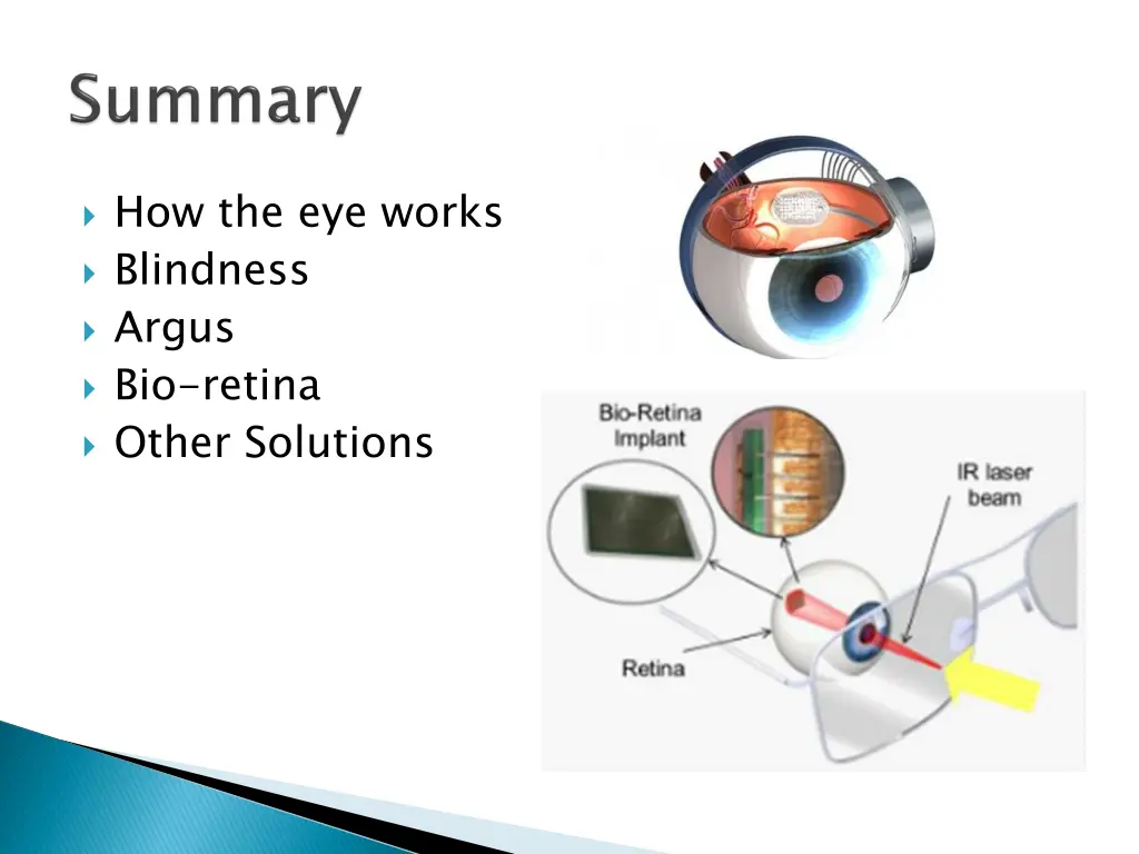 how the eye works blindness argus bio retina 1