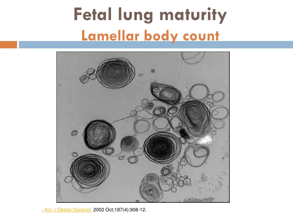 fetal lung maturity lamellar body count