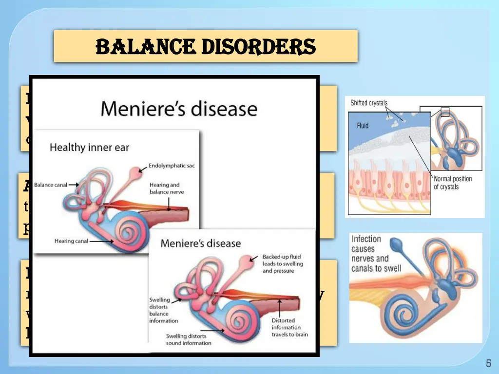 balance disorders balance disorders