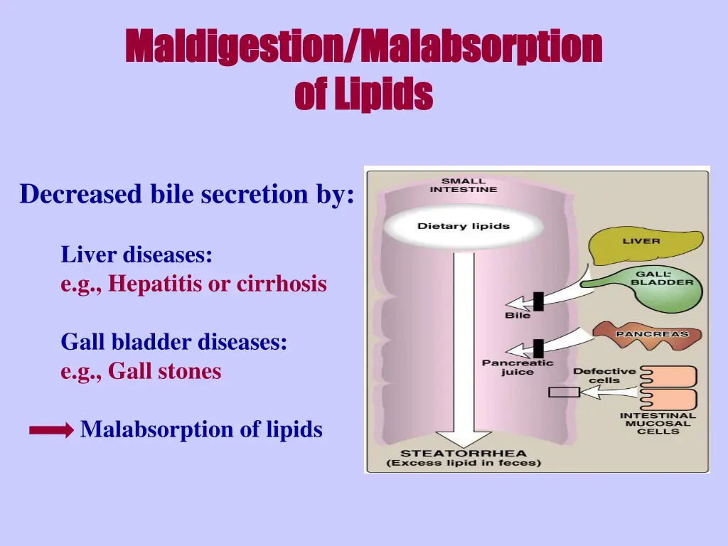 maldigestion maldigestion malabsorption