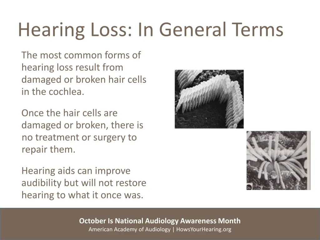 hearing loss in general terms