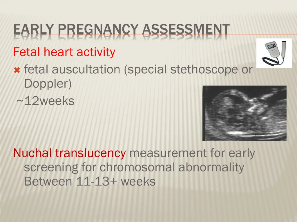 early pregnancy assessment