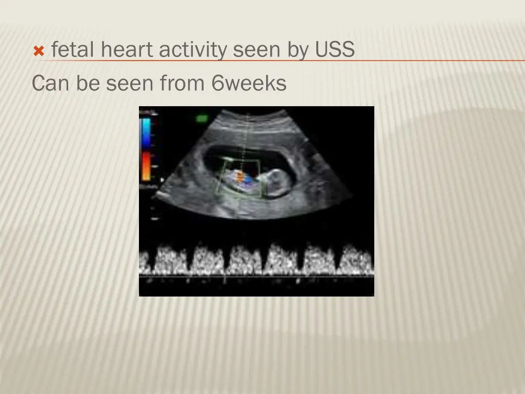 fetal heart activity seen by uss can be seen from