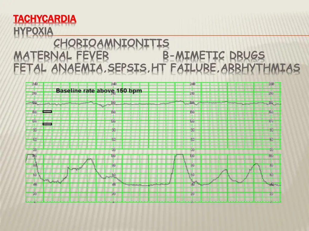 tachycardia tachycardia hypoxia hypoxia
