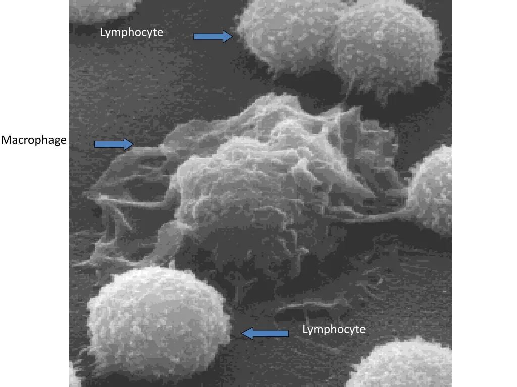 lymphocyte