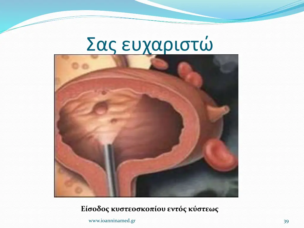 slide39