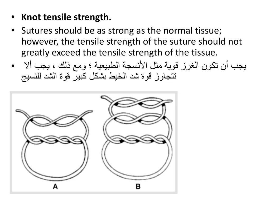 knot tensile strength sutures should be as strong