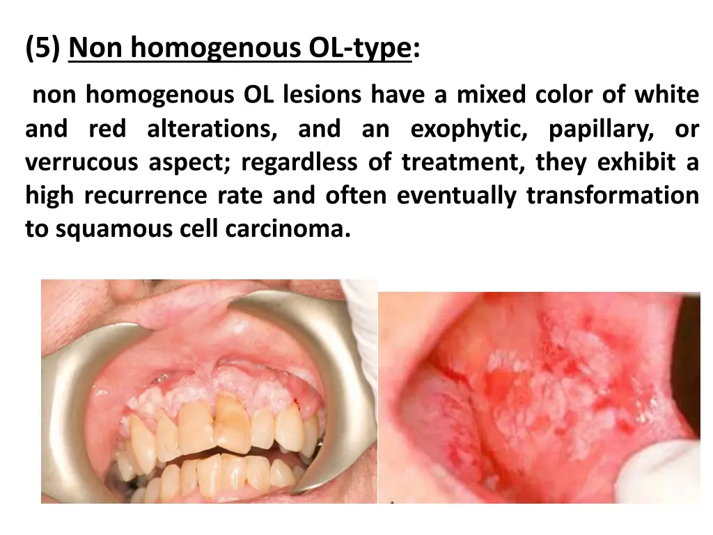 5 non homogenous ol type non homogenous