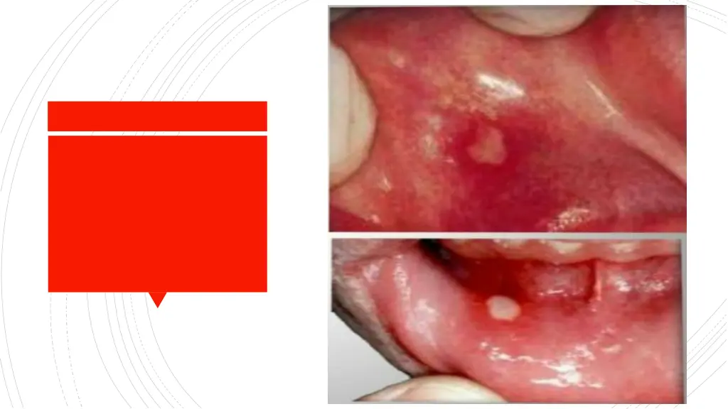 slide11
