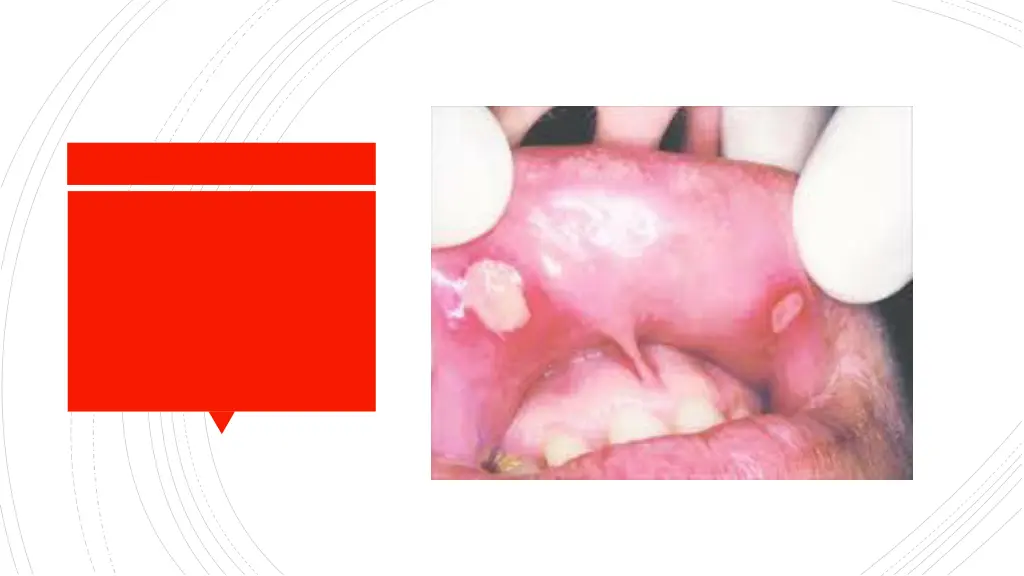 slide15
