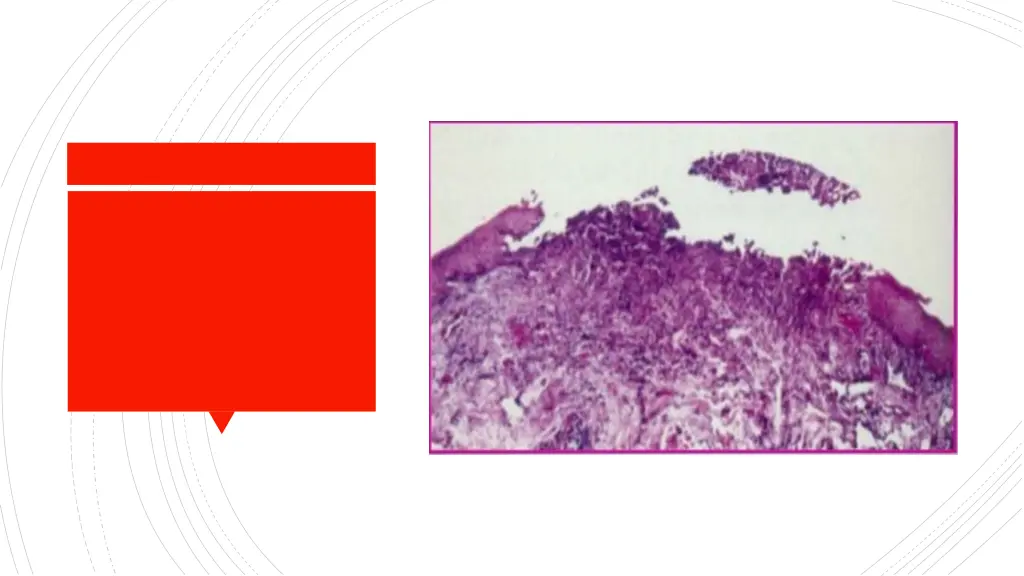 slide22